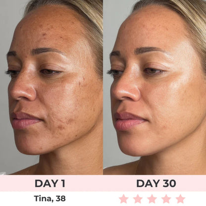 7-in-1 LED Facial Sculptor