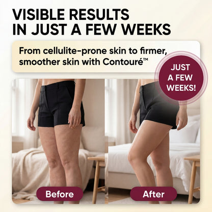 Contouré™ - Advanced Contouring Technology for Firmer, Toned-Looking Skin