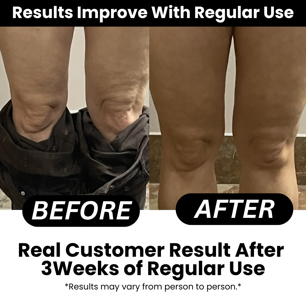 Anti-cellulite Massage Oil